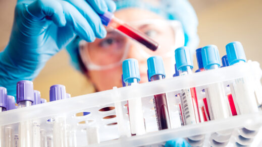 Lab technician with head cover and gloved hands placing a test tube with blood into a tray filled with other test tubes.
